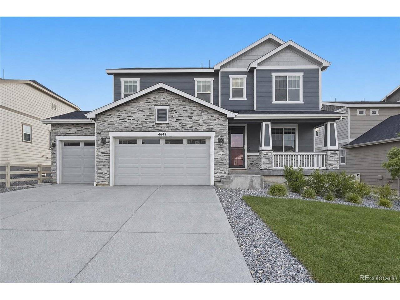 4647 Gray Wolf, Castle Rock, CO 80104