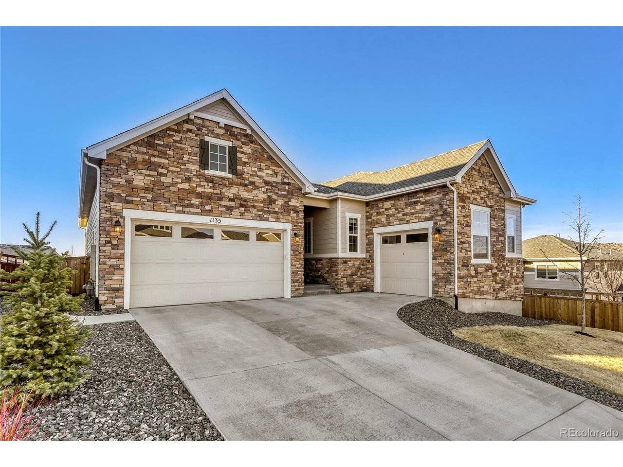 1135 Sunlit, Castle Rock, CO 80109