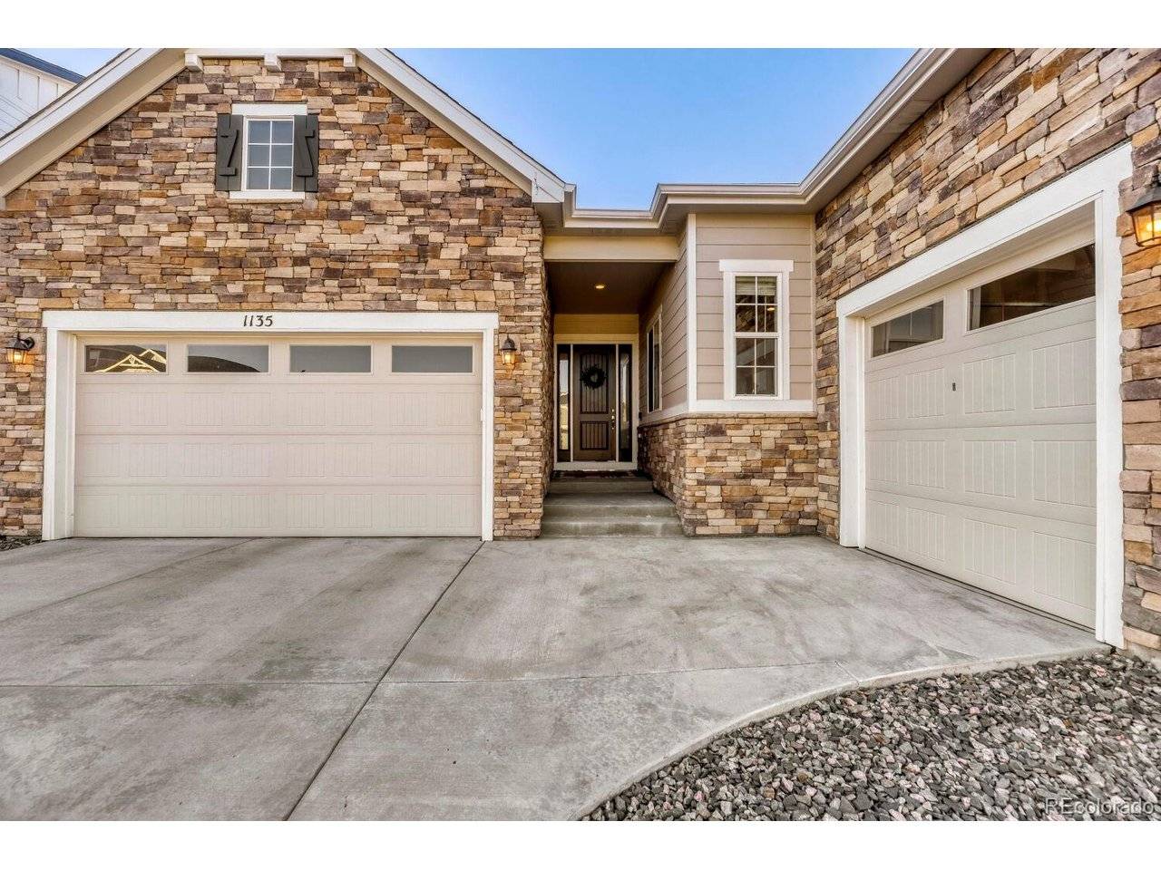 1135 Sunlit, Castle Rock, CO 80109